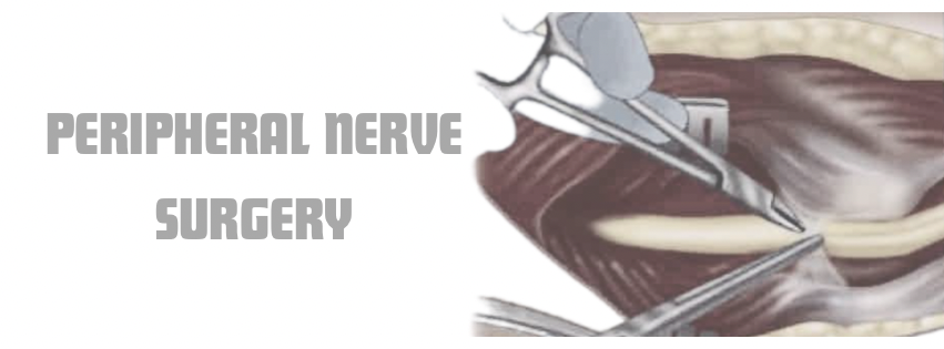 Peripheral Nerve (Nerve Surgery) - Dr. Nanthini Aesthetic & Reconstructive Surgery